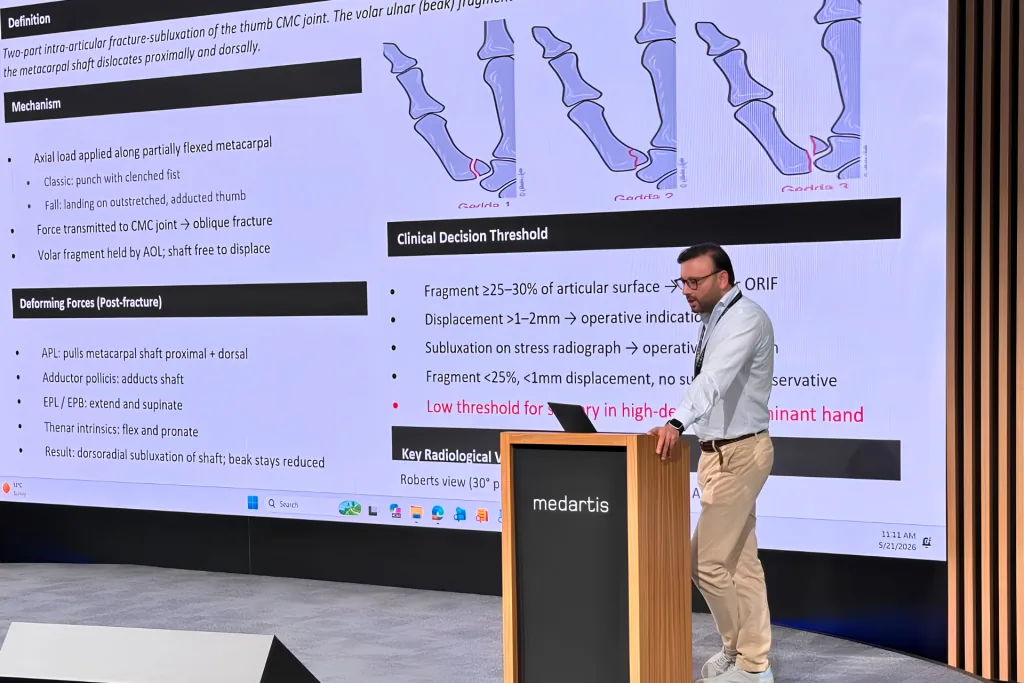 Prof. Dr. Sami Hassan lecturing at a podium in front of a slide on thumb-base fractures