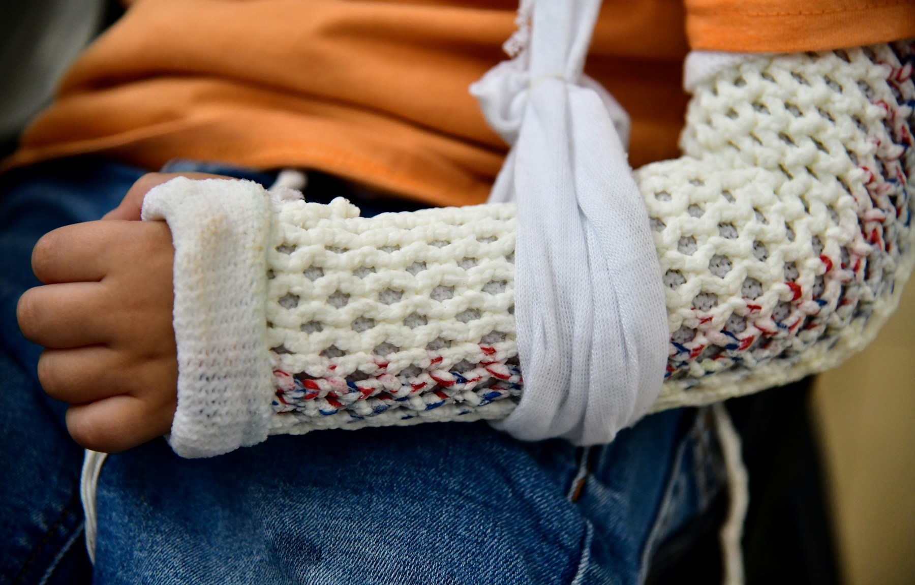 Close-up of an arm supported in a cast and sling after an injury